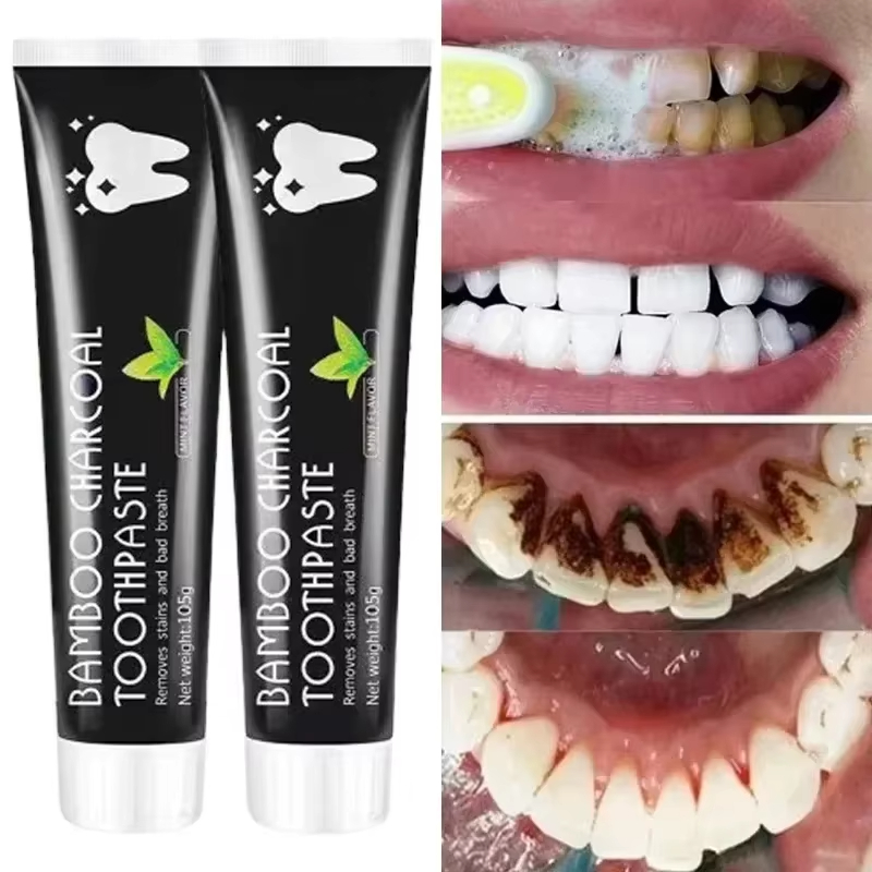 Teeth Whitening Charcoal - Clareador creme dental de carvão de
