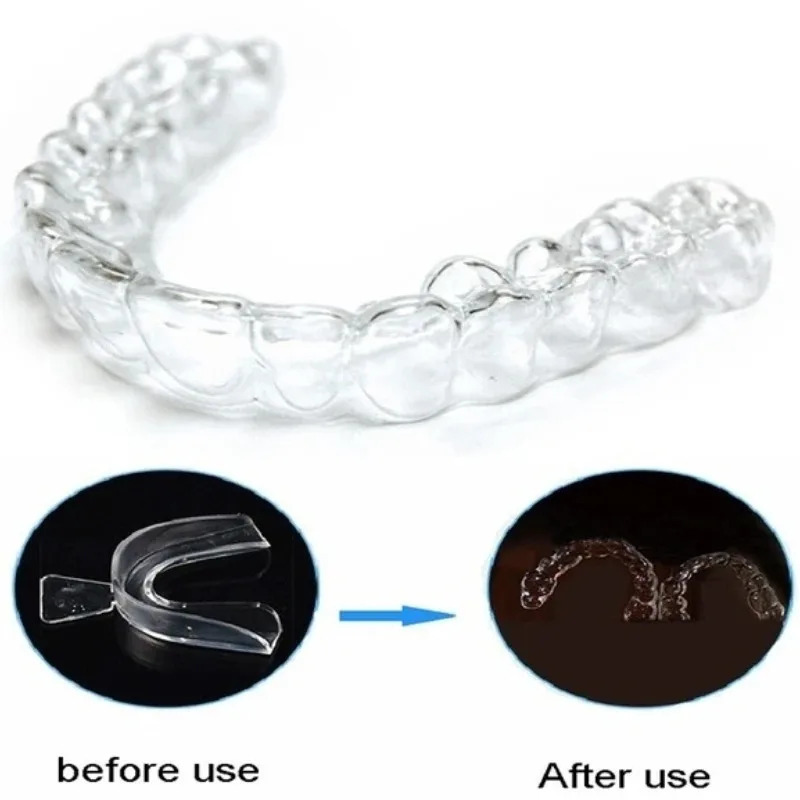 Protetor Bucal de Silicone (1/ - Teeth Whitening Mouth Guard avaliação e preço