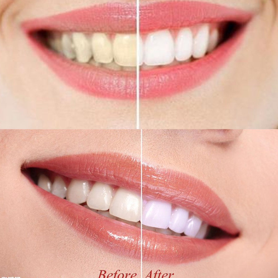 Dentes de carvão vegetal de ba - Teeth Whitening Charcoal avaliação e preço