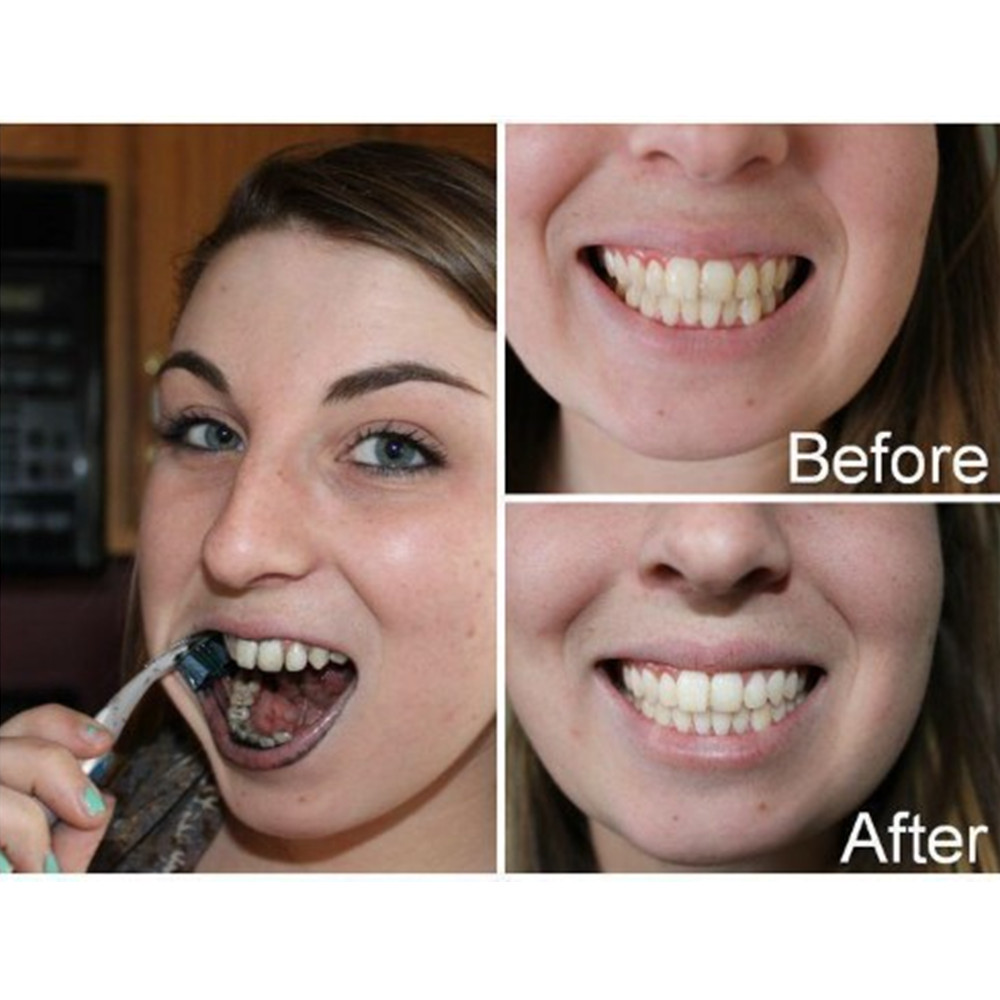 Dentes de carvão vegetal de ba - Teeth Whitening Charcoal avaliação e preço
