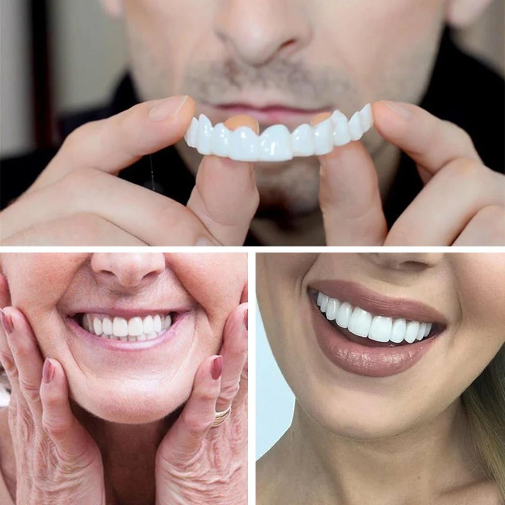 Novas Facetas Dentárias Reutil - Teeth Whitening Video avaliação e preço