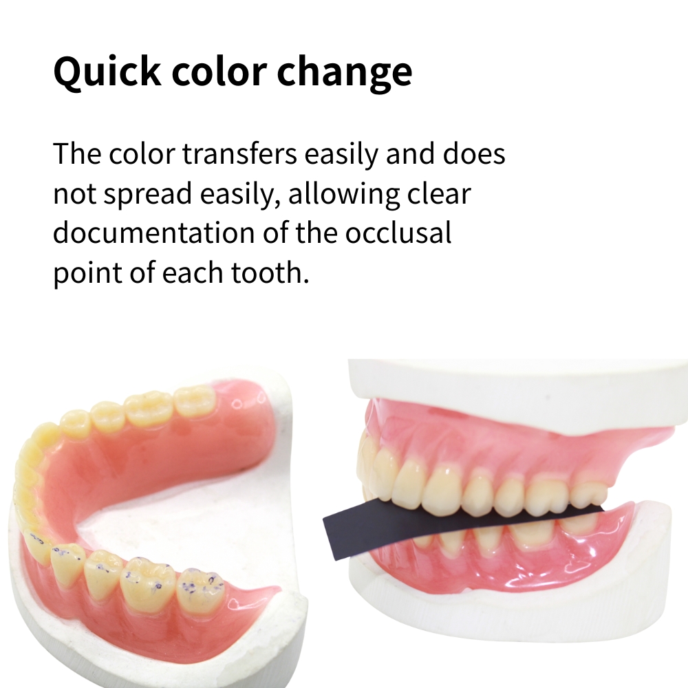 Papel de Articulação Odontológ - Teeth Whitening Retainer avaliação e preço