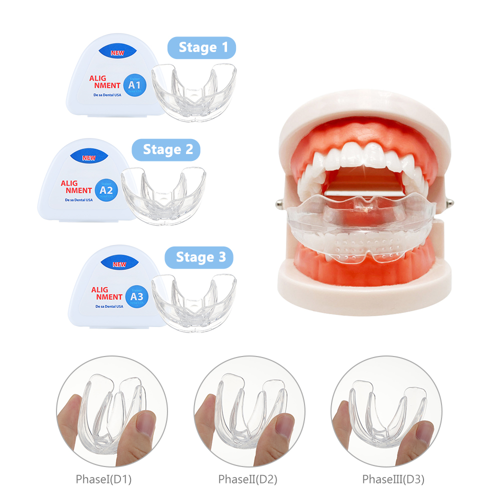 Dental ortodôntico chaves conj - Teeth Whitening Mouth Guard avaliação e preço