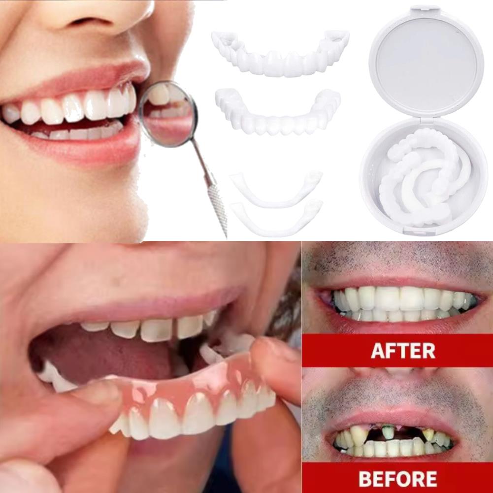 Novas Facetas Dentárias Reutil - Teeth Whitening Video avaliação e preço