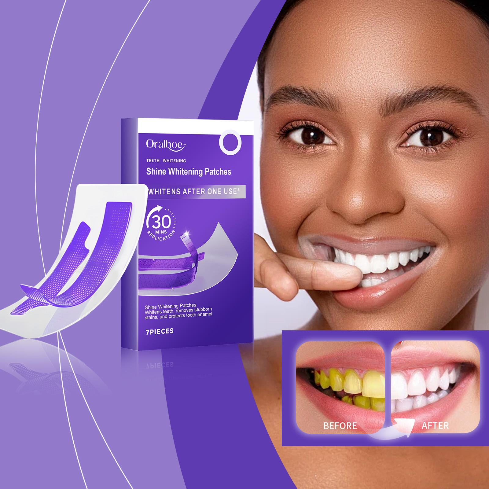 Tiras Clareadoras de Dentes Ro - Teeth Whitening Retainer avaliação e preço