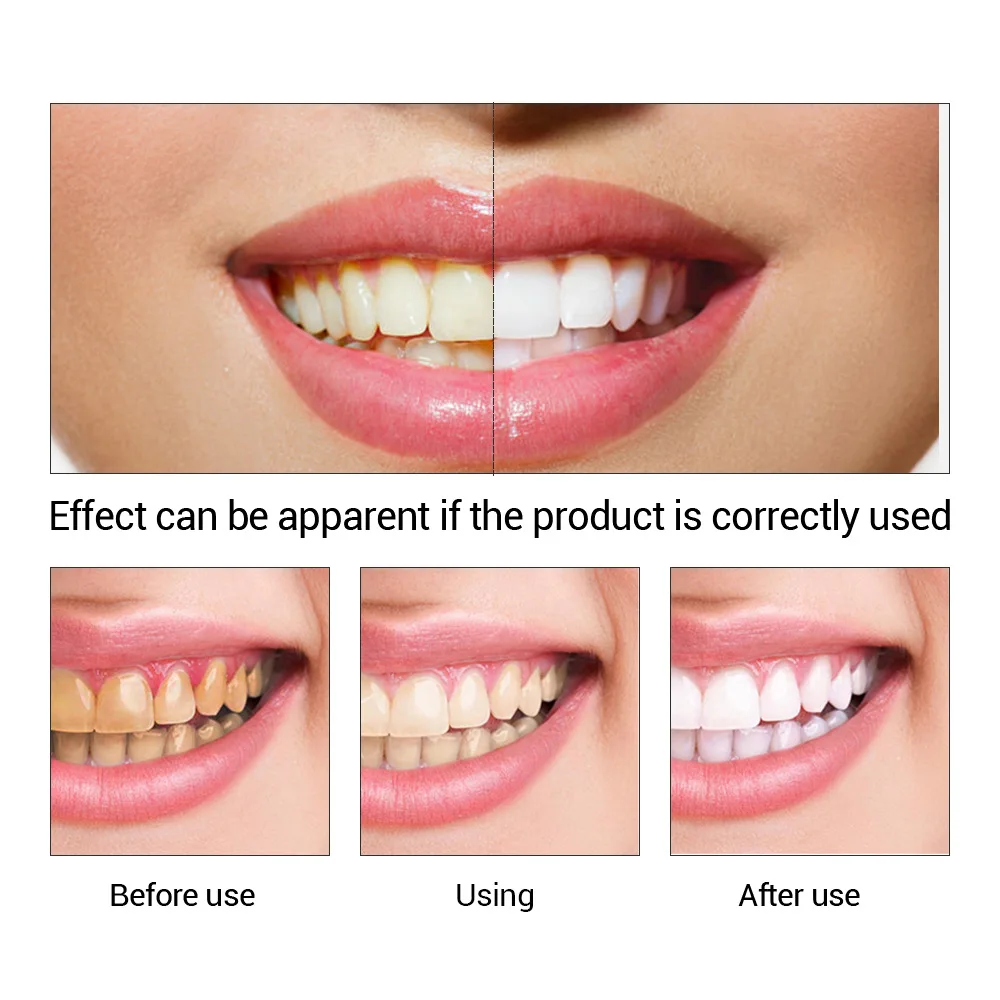 FTEENPLY Essência para claream - Teeth Whitening Session avaliação e preço