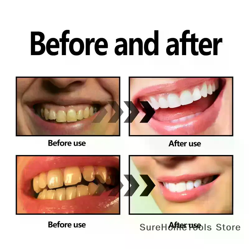 Pó de carvão de bambu para den - Teeth Whitening Charcoal avaliação e preço