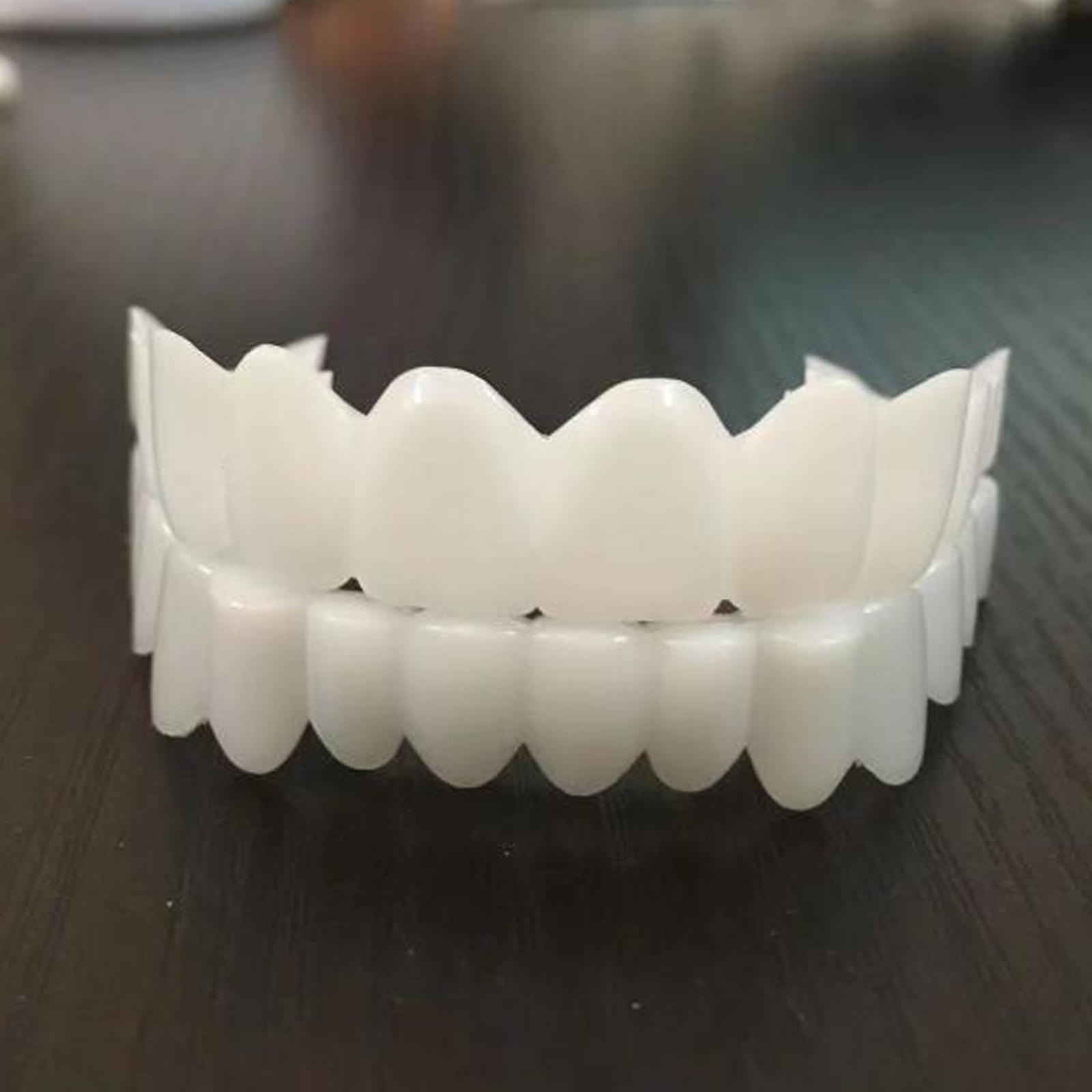 Novas Facetas Dentárias Especi - Teeth Whitening Video avaliação e preço