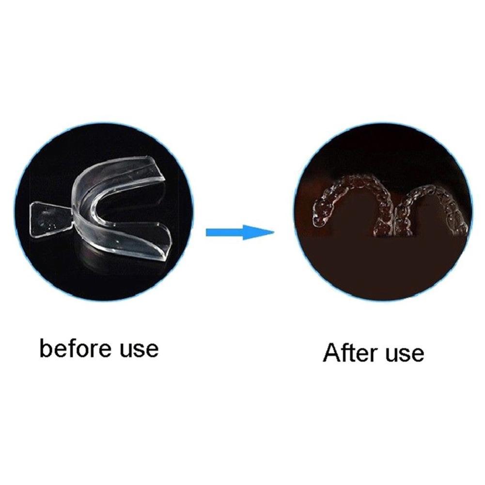 Protetor Bucal de Silicone par - Teeth Whitening Mouth Guard avaliação e preço