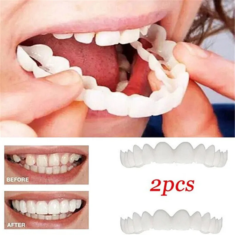Novas Facetas Dentárias Especi - Teeth Whitening Video avaliação e preço