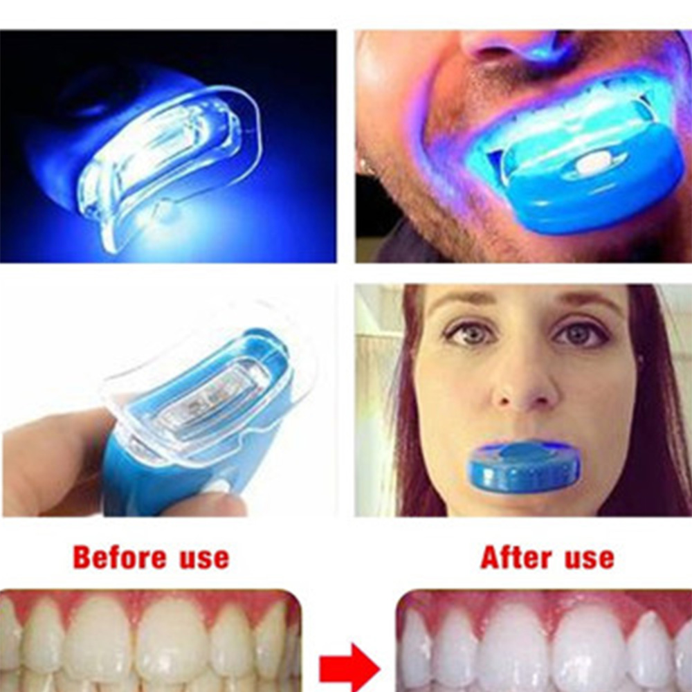 Acelerador de clareamento dent - Teeth Whitening Video avaliação e preço