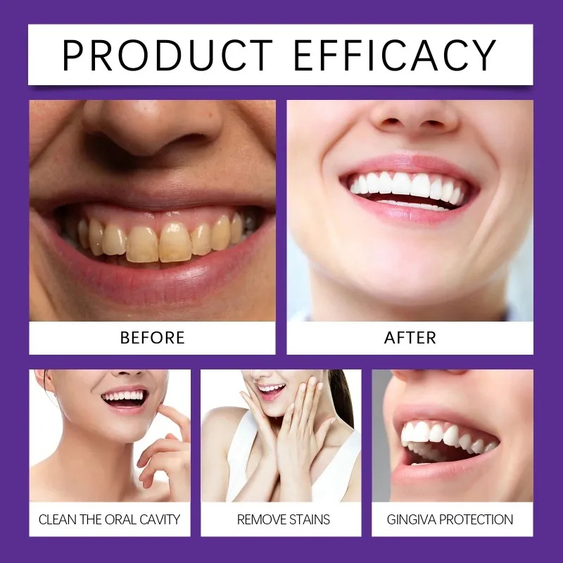 Pó Mineral Restaurador de Dent - Teeth Whitening Session avaliação e preço